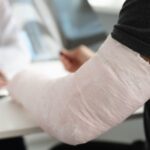 A man with a broken arm speaking with a doctor.